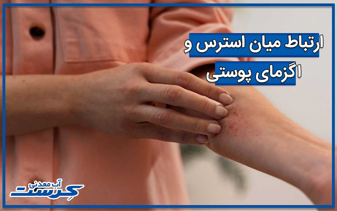 ارتباط میان استرس و اگزمای پوستی
