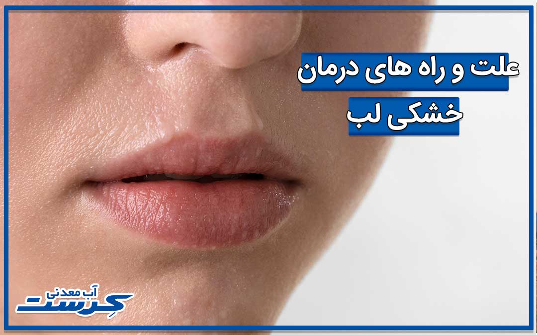 درمان خشکی لب در زمستان سریع و راحت